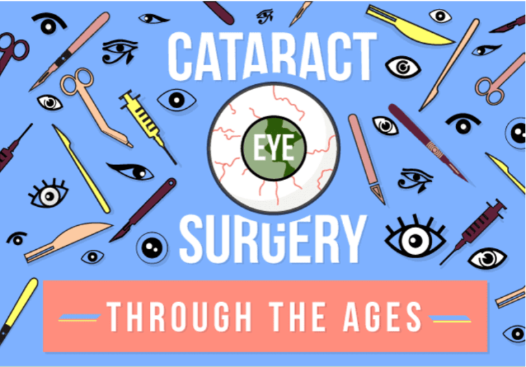 Modern Cataract Surgery: Precision, Efficiency, and Patient Outcomes